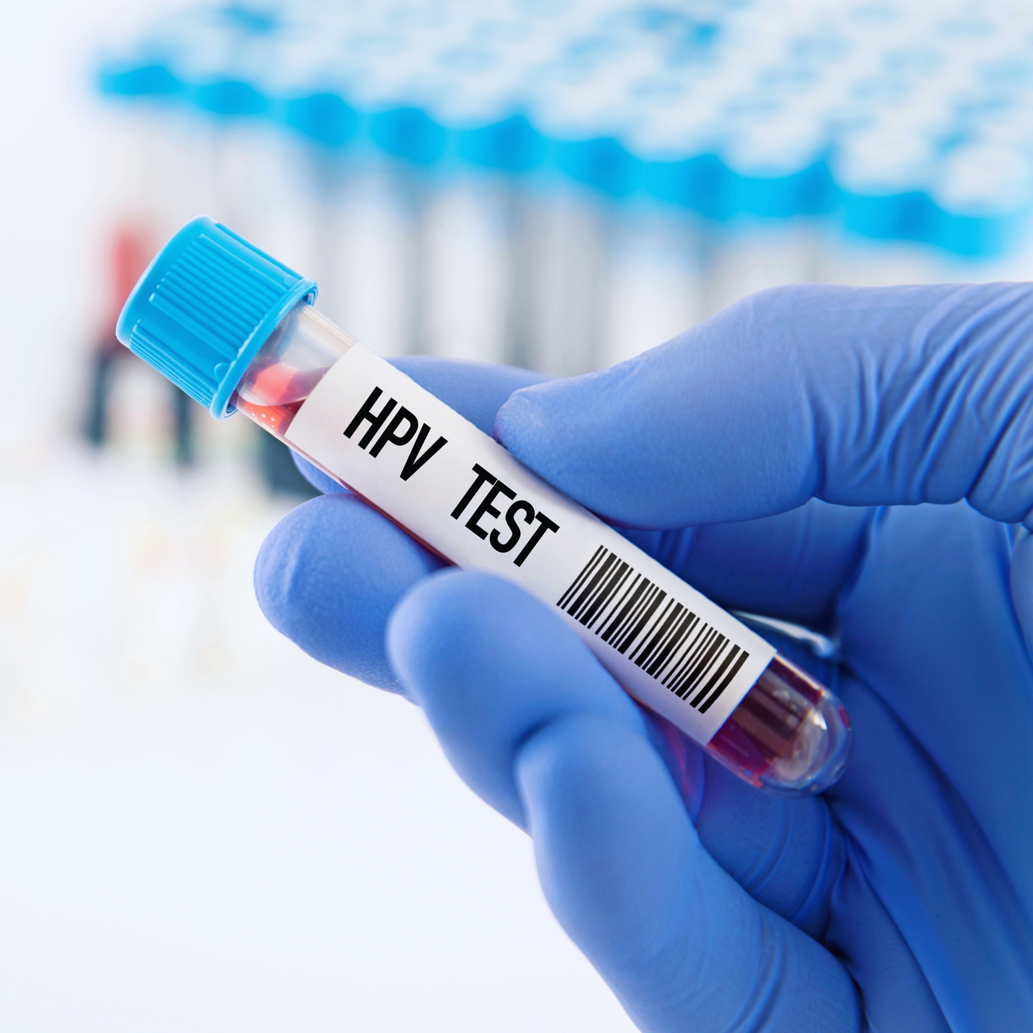 IMAGEN PRUEBA DE VPH - AMPLIGEN